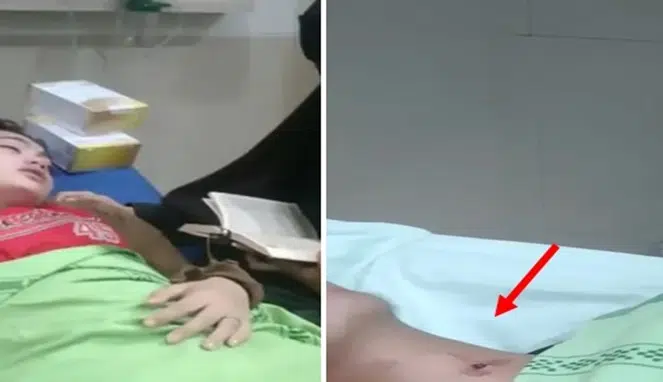 Teror Geng Motor di Makassar: Dua Karyawan Kafe Jadi Korban Serangan Busur