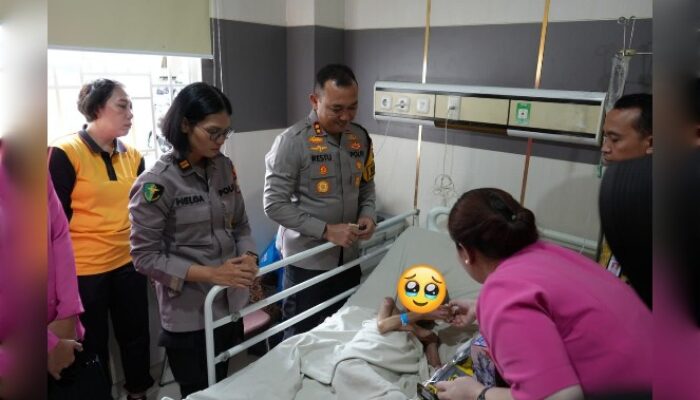 Polres Pelabuhan Makassar Selamatkan Bocah Disekap dengan Tubuh Penuh Luka Bakar