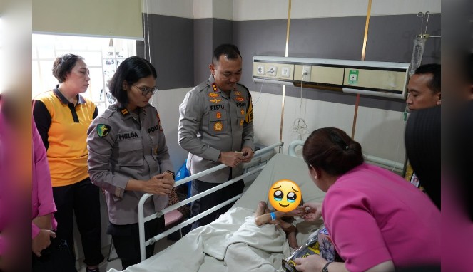 Polres Pelabuhan Makassar Selamatkan Bocah Disekap dengan Tubuh Penuh Luka Bakar
