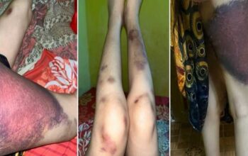 Dituduh Selingkuh, IRT Hamil di Bulukumba Ngaku Ditendang Suami Puluhan Kali