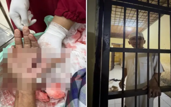 Tokoh Masyarakat Jeneponto Jadi Korban Brutal, Tangan Nyaris Putus Kini Mendekam di Sel