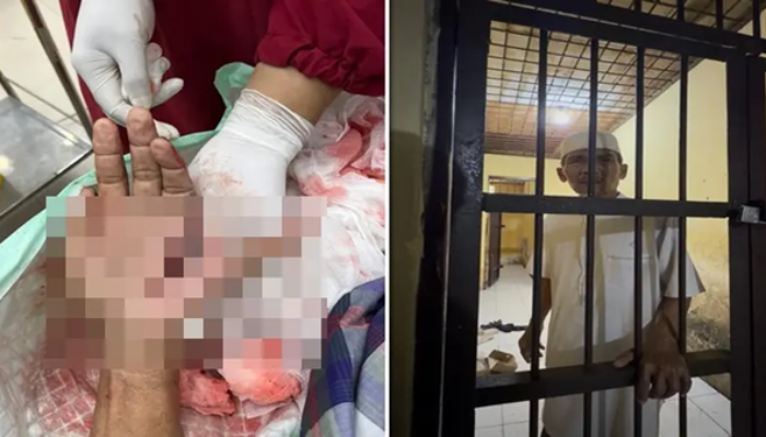 Tokoh Masyarakat Jeneponto Jadi Korban Brutal, Tangan Nyaris Putus Kini Mendekam di Sel