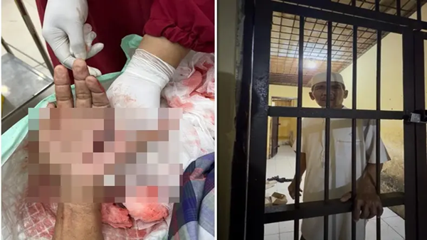 Tokoh Masyarakat Jeneponto Jadi Korban Brutal, Tangan Nyaris Putus Kini Mendekam di Sel